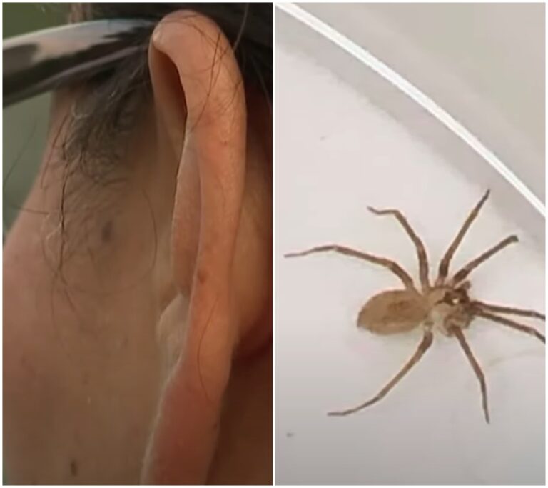 Hororový příběh: Pavouk s jedovatým kousnutím objeven v uchu ženy – Jak se chránit před podobnými nočními můrami?